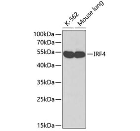 Western Blot - Anti-MUM1 Antibody (A12977) - Antibodies.com