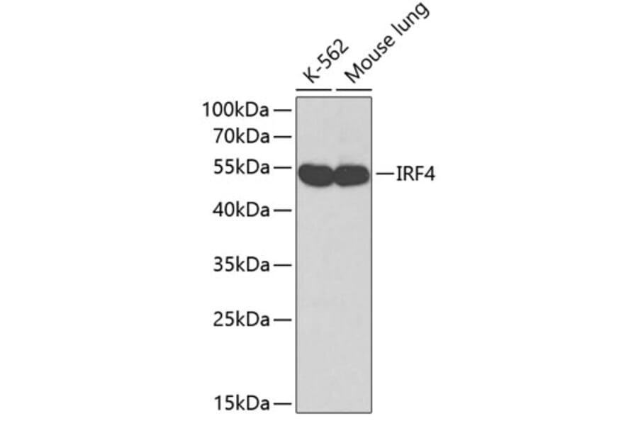 Western Blot - Anti-MUM1 Antibody (A12977) - Antibodies.com