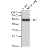 Western Blot - Anti-MUM1 Antibody (A12977) - Antibodies.com