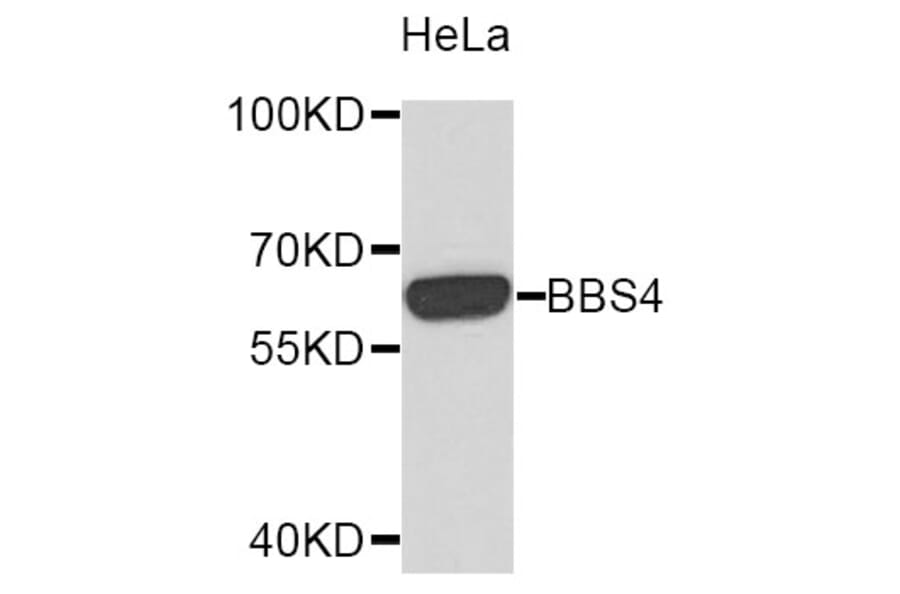Western Blot - Anti-BBS4 Antibody (A10523) - Antibodies.com