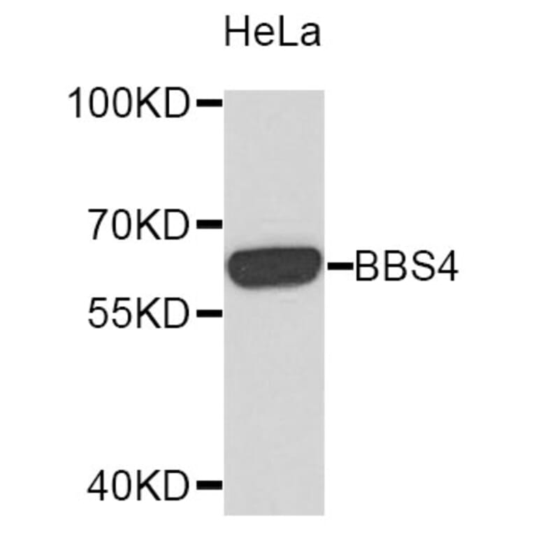 Western Blot - Anti-BBS4 Antibody (A10523) - Antibodies.com