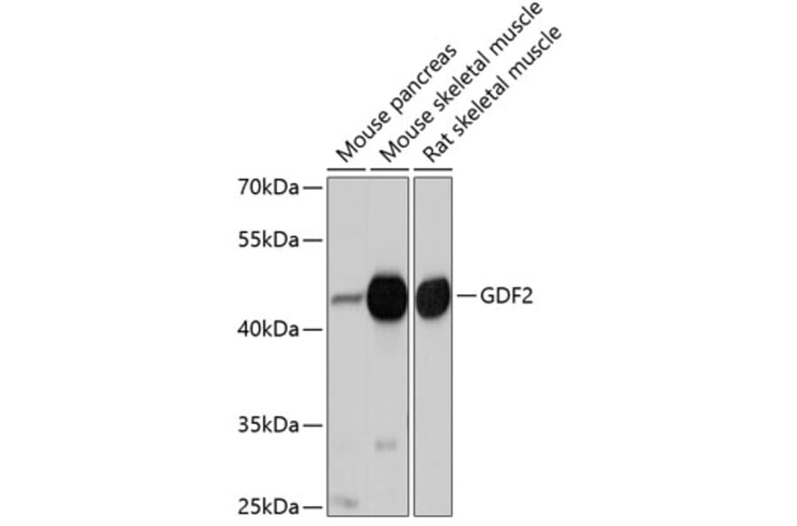 Western Blot - Anti-BMP9 Antibody (A12984) - Antibodies.com