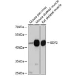 Western Blot - Anti-BMP9 Antibody (A12984) - Antibodies.com