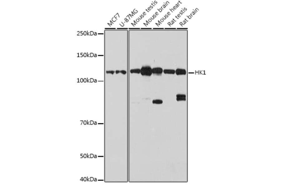 Western Blot - Anti-Hexokinase 1 Antibody (A12985) - Antibodies.com