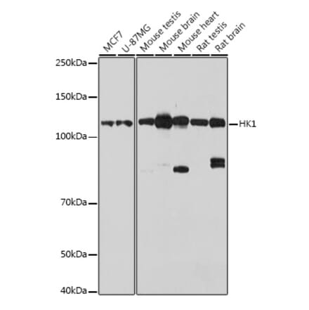 Western Blot - Anti-Hexokinase 1 Antibody (A12985) - Antibodies.com
