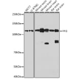 Western Blot - Anti-Hexokinase 1 Antibody (A12985) - Antibodies.com