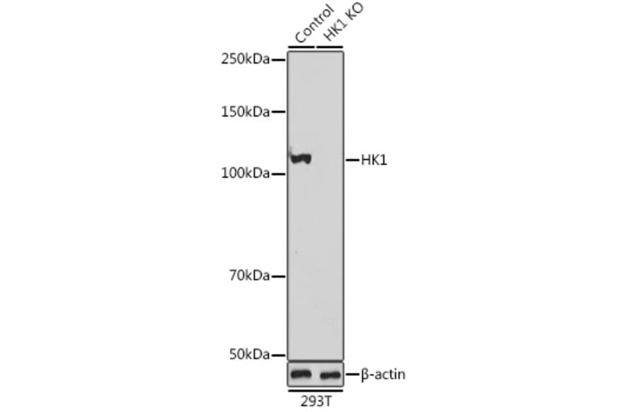 Western Blot - Anti-Hexokinase 1 Antibody (A12985) - Antibodies.com