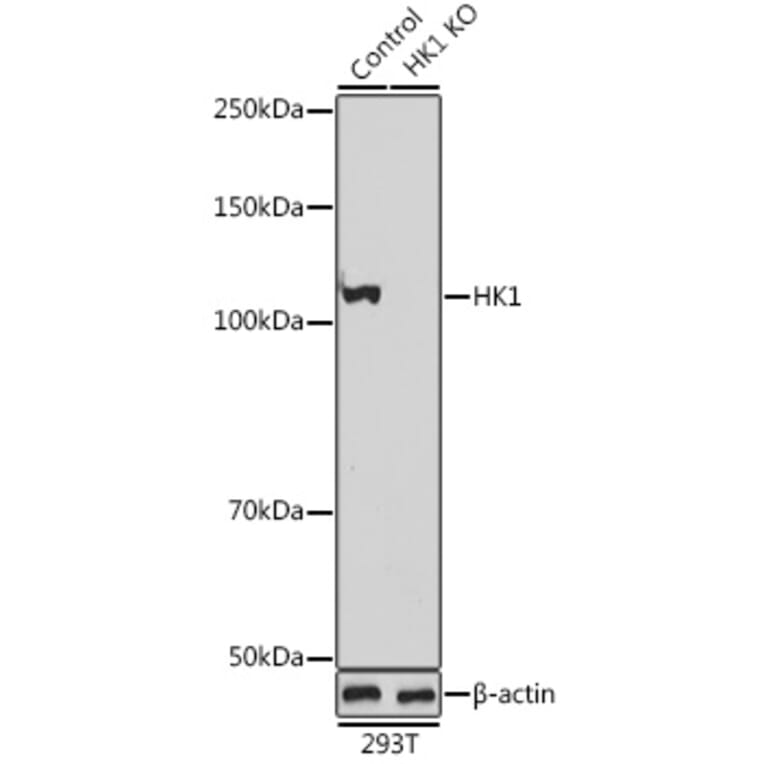 Western Blot - Anti-Hexokinase 1 Antibody (A12985) - Antibodies.com