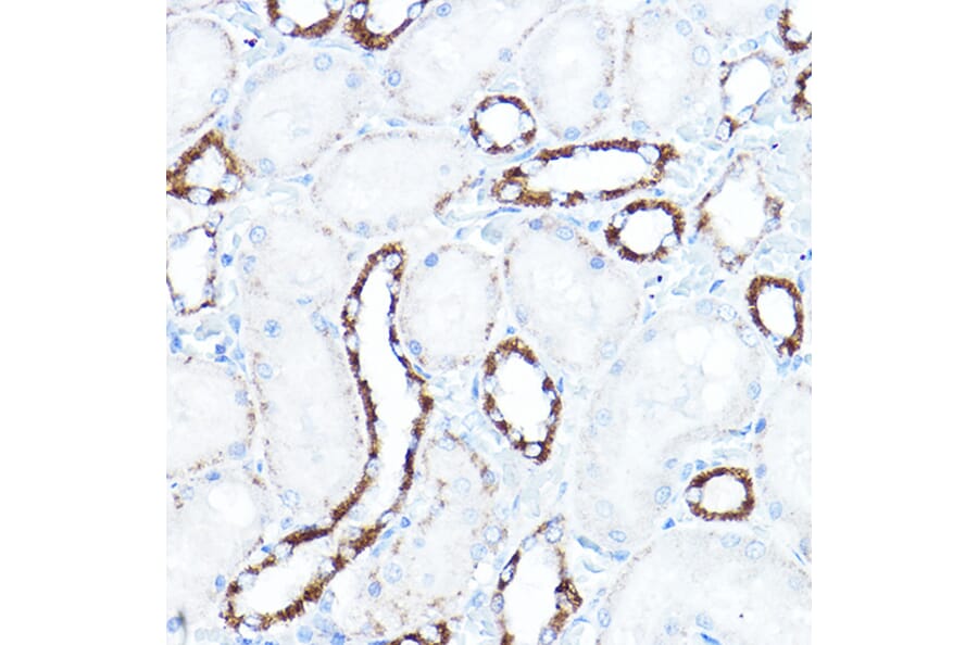 Immunohistochemistry - Anti-Hexokinase 1 Antibody (A12985) - Antibodies.com