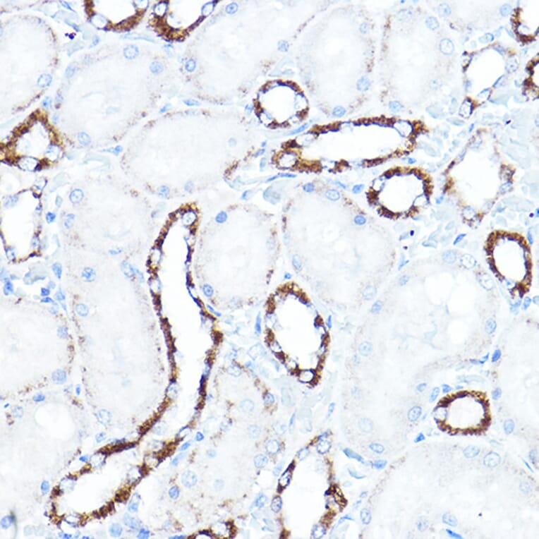 Immunohistochemistry - Anti-Hexokinase 1 Antibody (A12985) - Antibodies.com