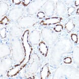 Immunohistochemistry - Anti-Hexokinase 1 Antibody (A12985) - Antibodies.com