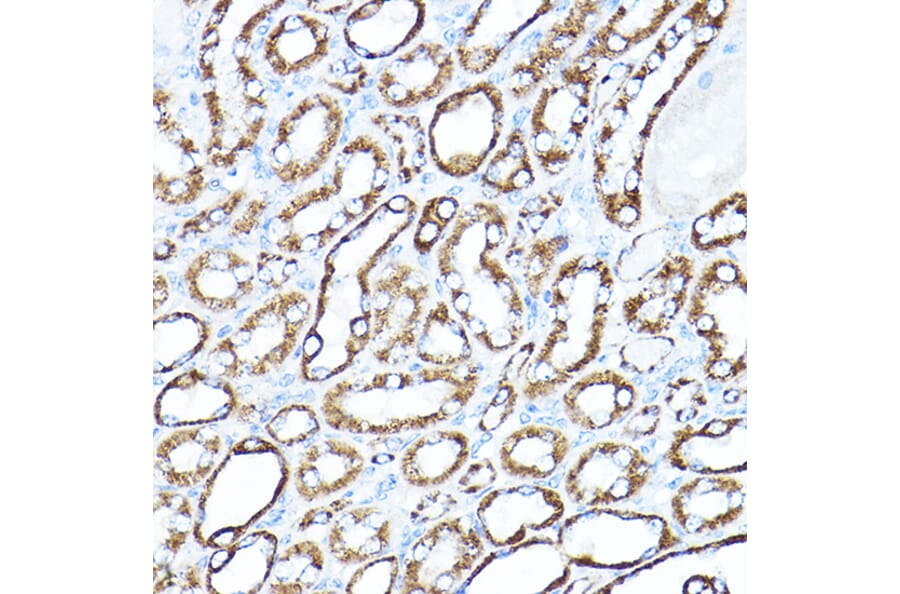 Immunohistochemistry - Anti-Hexokinase 1 Antibody (A12985) - Antibodies.com