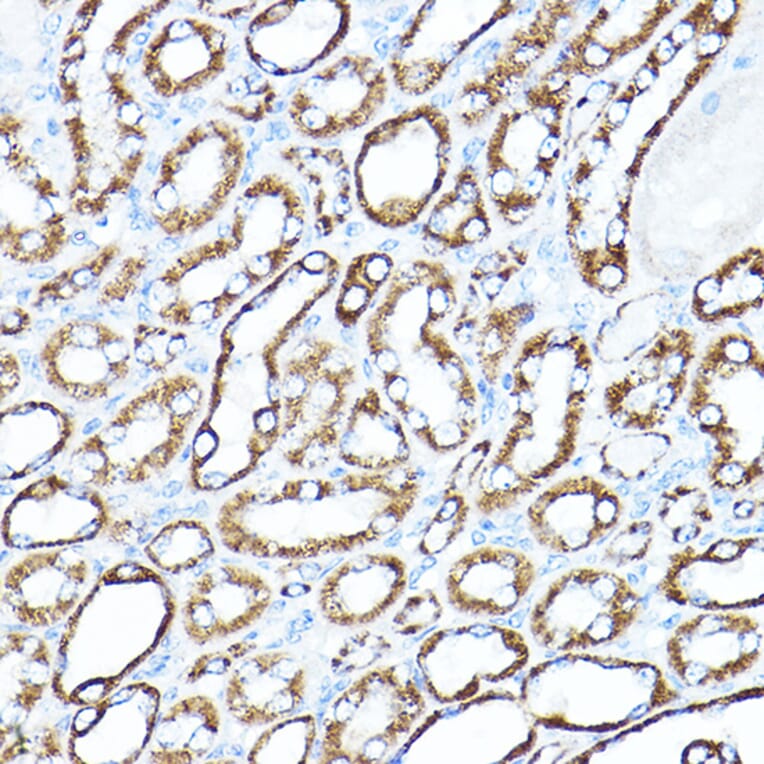 Immunohistochemistry - Anti-Hexokinase 1 Antibody (A12985) - Antibodies.com