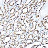 Immunohistochemistry - Anti-Hexokinase 1 Antibody (A12985) - Antibodies.com
