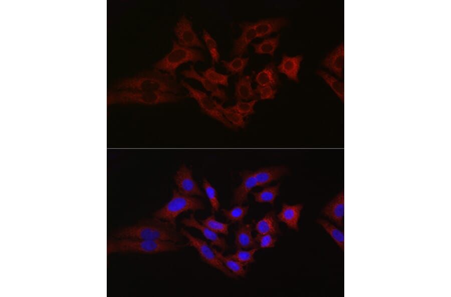 Immunofluorescence - Anti-Hexokinase 1 Antibody (A12985) - Antibodies.com