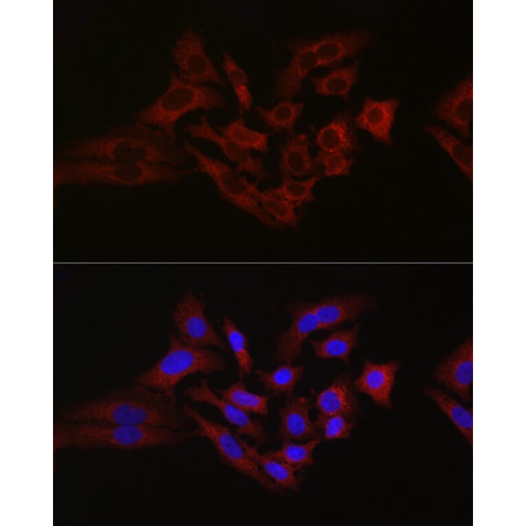 Immunofluorescence - Anti-Hexokinase 1 Antibody (A12985) - Antibodies.com