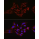 Immunofluorescence - Anti-Hexokinase 1 Antibody (A12985) - Antibodies.com