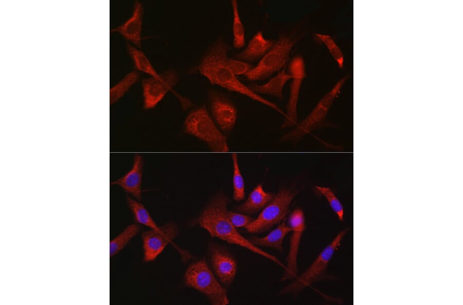 Immunofluorescence - Anti-Hexokinase 1 Antibody (A12985) - Antibodies.com