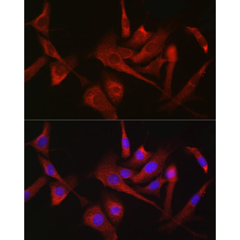 Immunofluorescence - Anti-Hexokinase 1 Antibody (A12985) - Antibodies.com