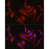 Immunofluorescence - Anti-Hexokinase 1 Antibody (A12985) - Antibodies.com