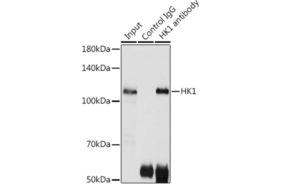 Western Blot - Anti-Hexokinase 1 Antibody (A12985) - Antibodies.com