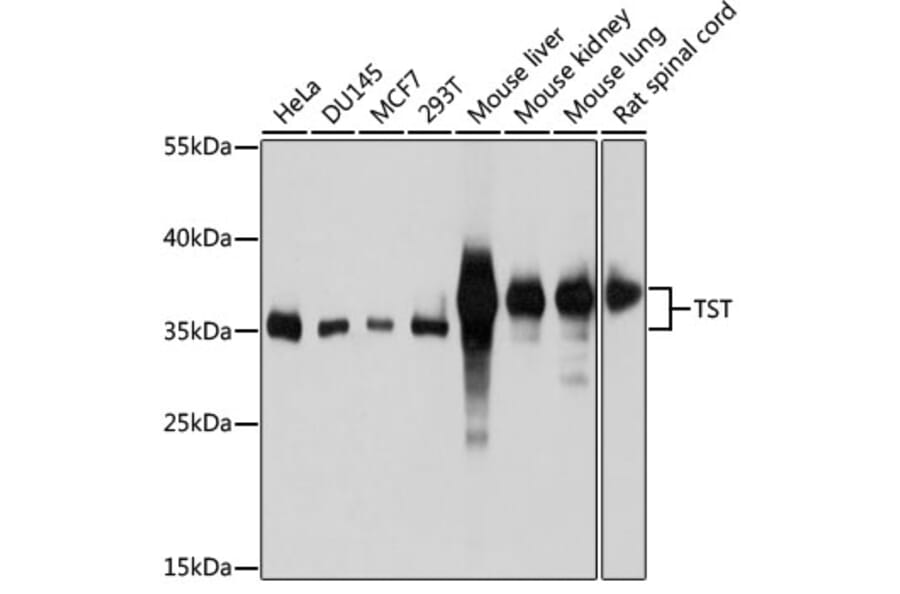 Western Blot - Anti-TST Antibody (A10542) - Antibodies.com