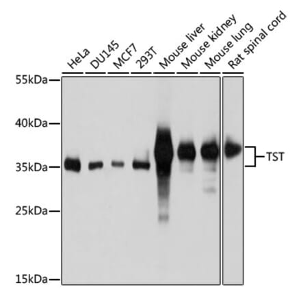 Western Blot - Anti-TST Antibody (A10542) - Antibodies.com