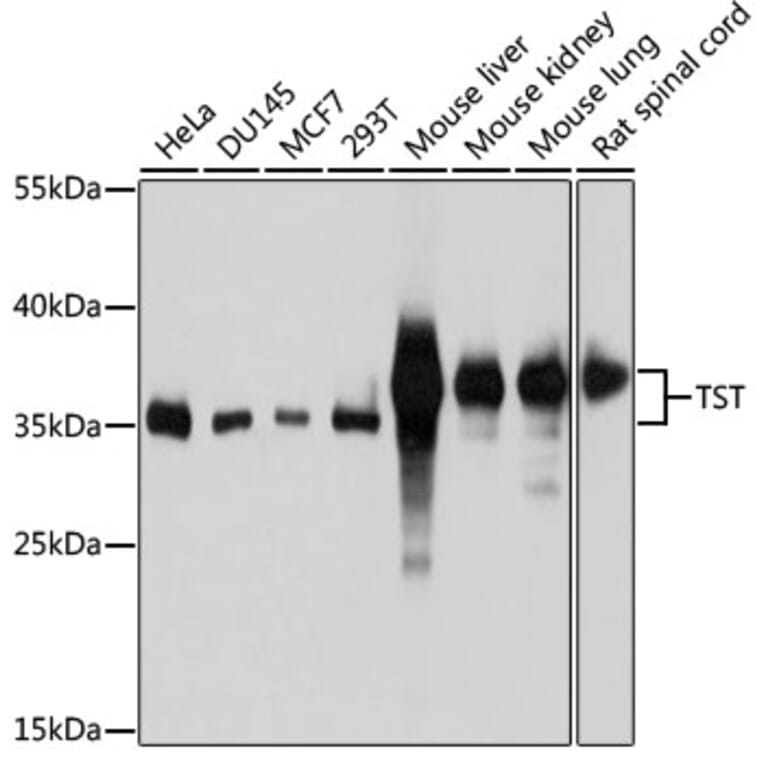 Western Blot - Anti-TST Antibody (A10542) - Antibodies.com