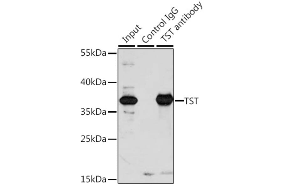 Immunoprecipitation - Anti-TST Antibody (A10542) - Antibodies.com