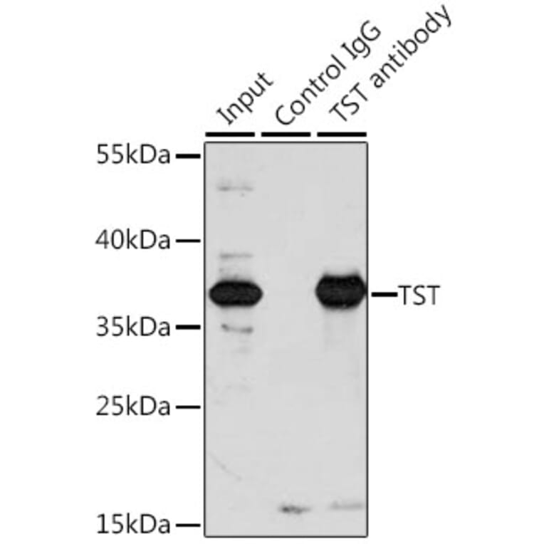 Immunoprecipitation - Anti-TST Antibody (A10542) - Antibodies.com