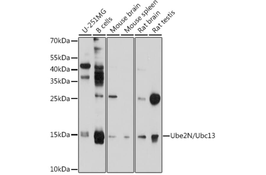 Western Blot - Anti-Ube2N/Ubc13 Antibody (A12987) - Antibodies.com