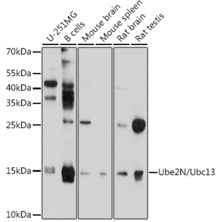 Western Blot - Anti-Ube2N/Ubc13 Antibody (A12987) - Antibodies.com