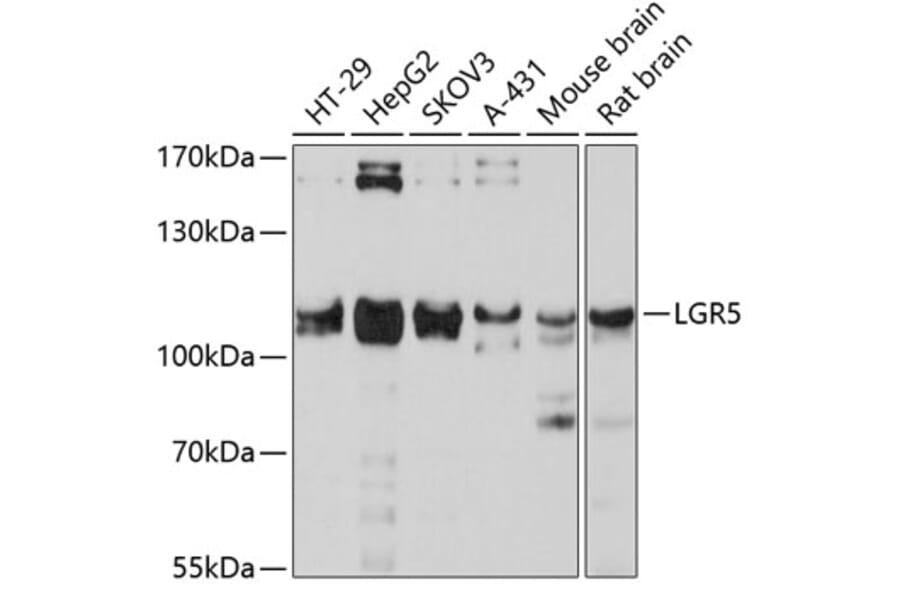 Western Blot - Anti-LGR5 Antibody (A10545) - Antibodies.com