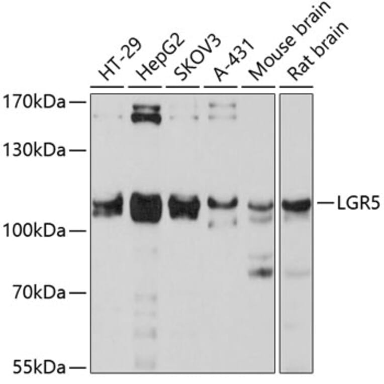 Western Blot - Anti-LGR5 Antibody (A10545) - Antibodies.com