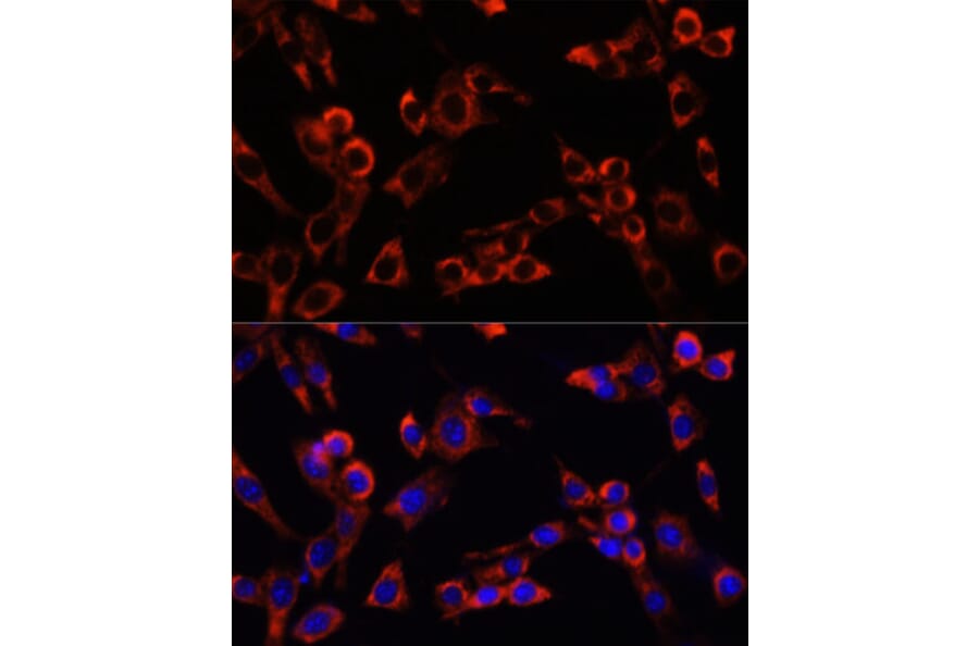 Anti-LGR5 Antibody (A12988) | Antibodies.com