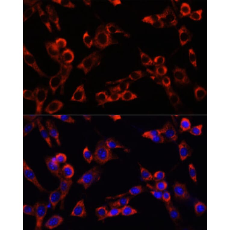 Immunofluorescence - Anti-LGR5 Antibody (A10545) - Antibodies.com
