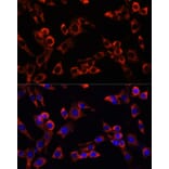 Immunofluorescence - Anti-LGR5 Antibody (A10545) - Antibodies.com