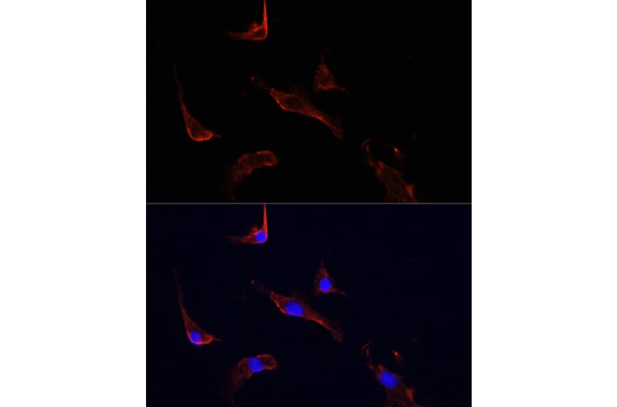 Immunofluorescence - Anti-LGR5 Antibody (A10545) - Antibodies.com