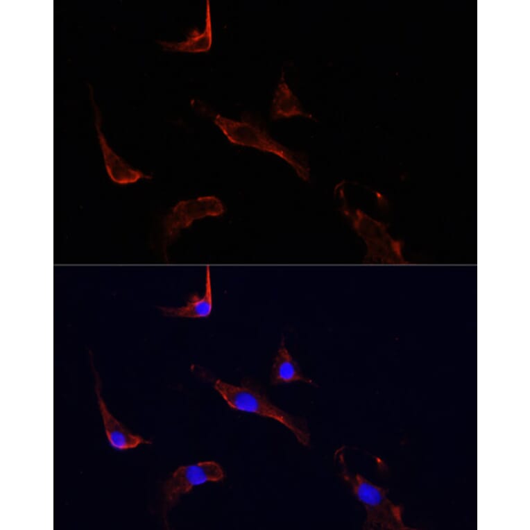 Immunofluorescence - Anti-LGR5 Antibody (A10545) - Antibodies.com
