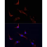 Immunofluorescence - Anti-LGR5 Antibody (A10545) - Antibodies.com