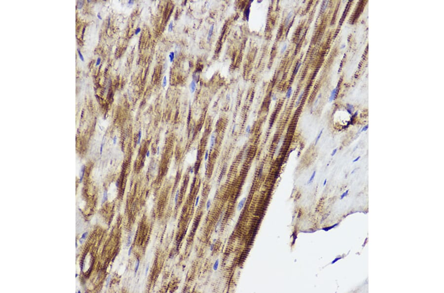 Immunohistochemistry - Anti-PLOD3 Antibody (A12989) - Antibodies.com