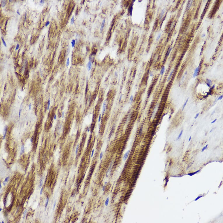 Immunohistochemistry - Anti-PLOD3 Antibody (A12989) - Antibodies.com