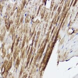 Immunohistochemistry - Anti-PLOD3 Antibody (A12989) - Antibodies.com