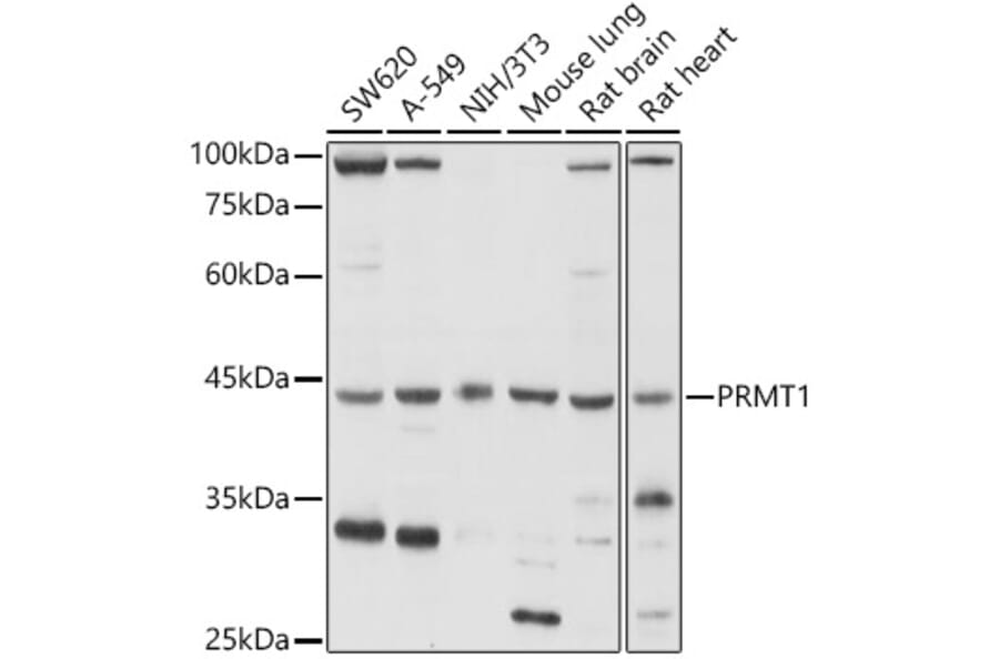 Western Blot - Anti-PRMT1 Antibody (A12991) - Antibodies.com