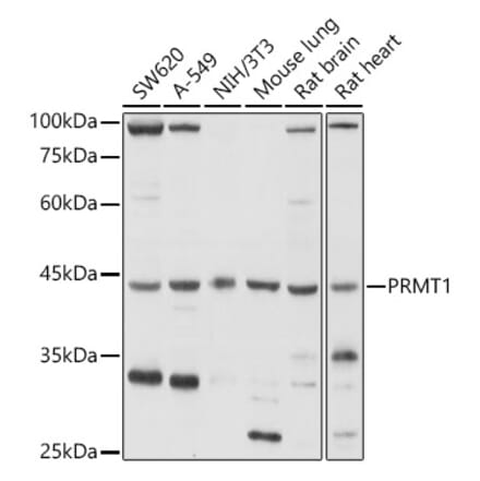 Western Blot - Anti-PRMT1 Antibody (A12991) - Antibodies.com