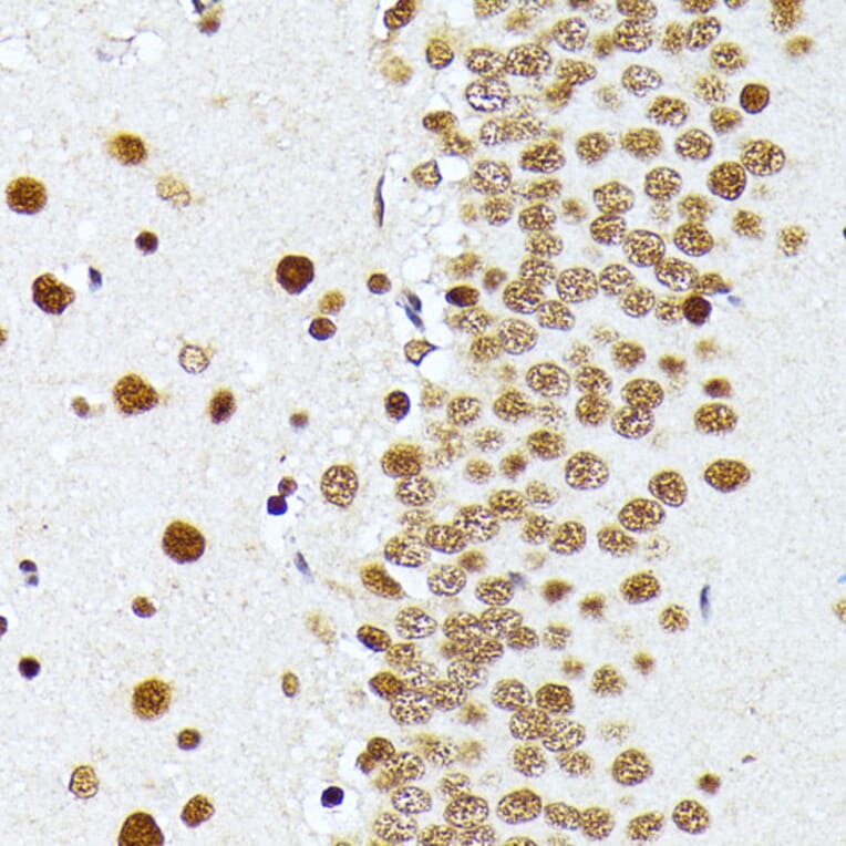 Immunohistochemistry - Anti-PRMT1 Antibody (A12991) - Antibodies.com