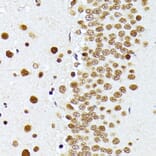 Immunohistochemistry - Anti-PRMT1 Antibody (A12991) - Antibodies.com