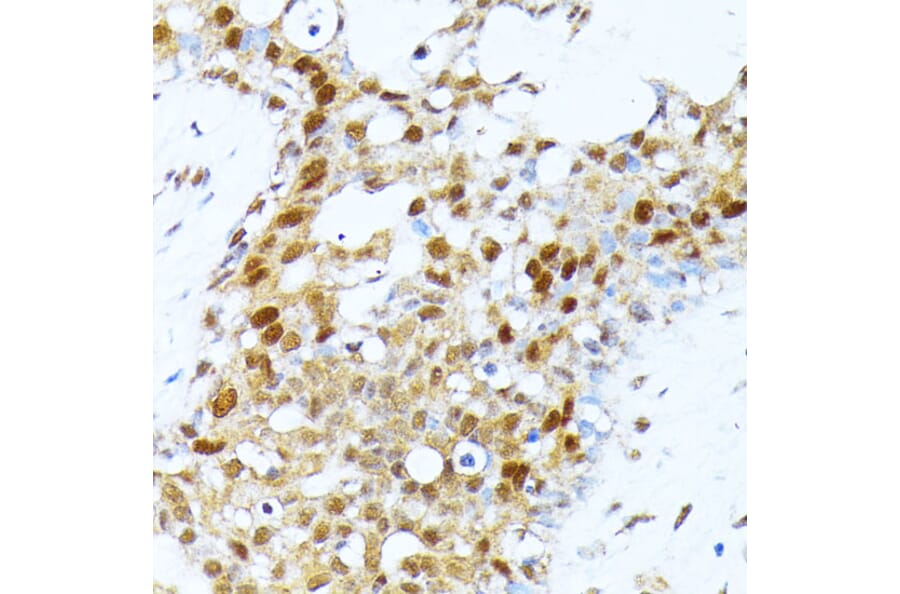 Immunohistochemistry - Anti-PRMT1 Antibody (A12991) - Antibodies.com