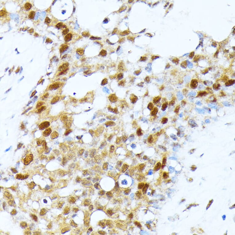 Immunohistochemistry - Anti-PRMT1 Antibody (A12991) - Antibodies.com