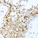 Immunohistochemistry - Anti-PRMT1 Antibody (A12991) - Antibodies.com